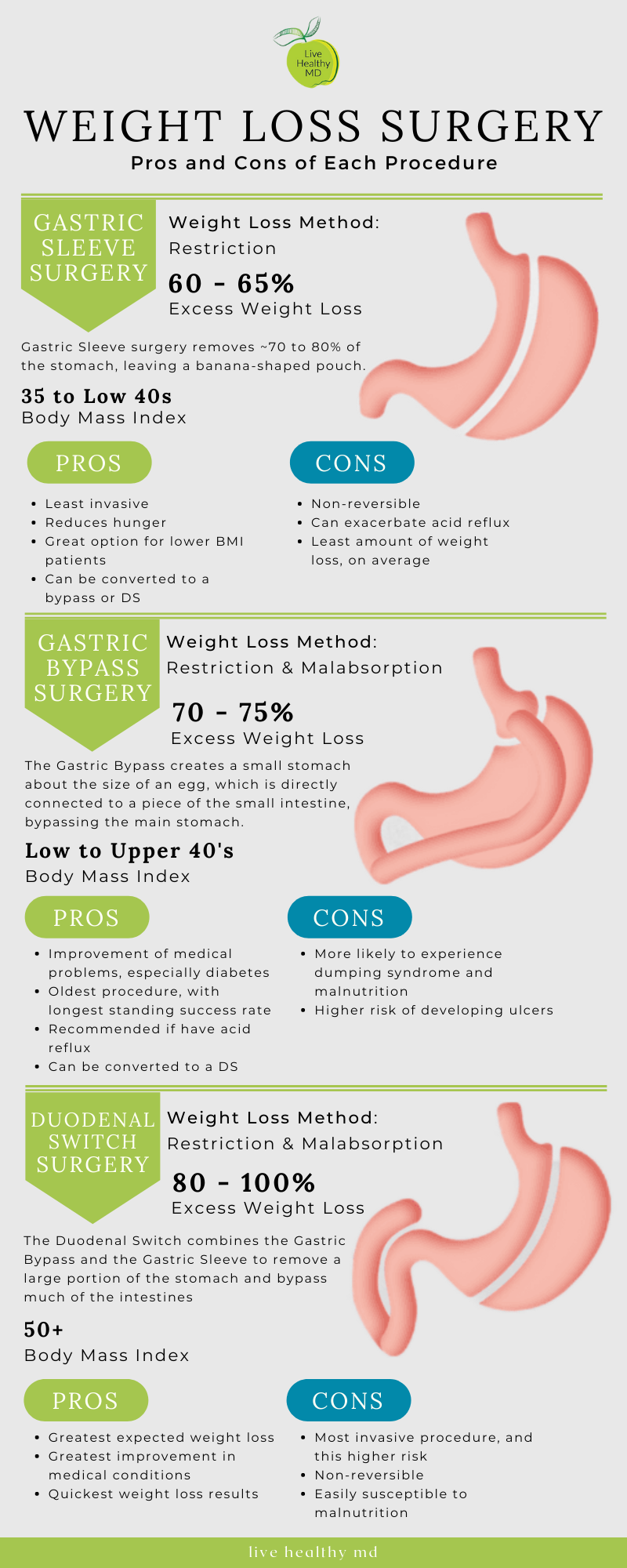 Choosing A Weight Loss Surgery Procedure Bca Blog 