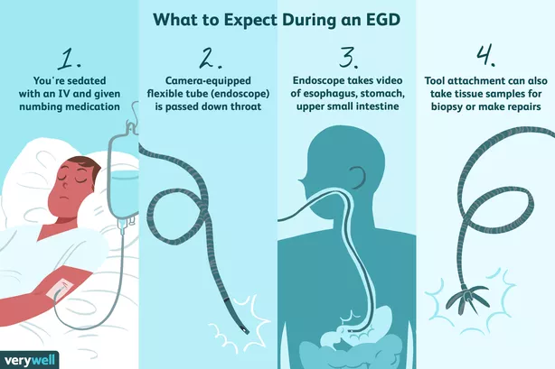 what to expect gastroenterology appointment