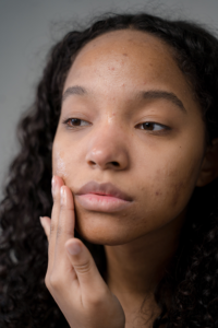 acne as a hormonal side effect of bariatric surgery