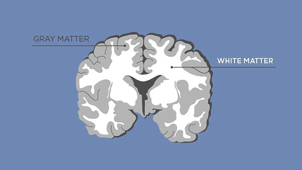 The link between brain volume and obesity with gray and white matter